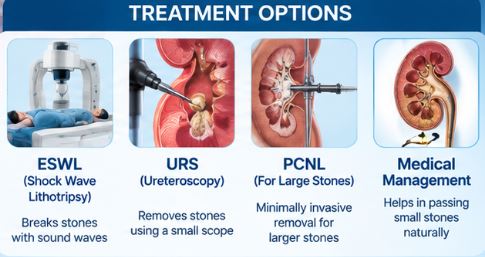 Kidney Stone Treatment